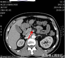 间歇性呕吐怎么回事,间歇性反酸