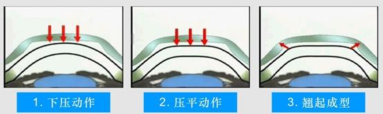 近视角膜塑形镜的利与弊,近视矫正角膜塑形镜价格