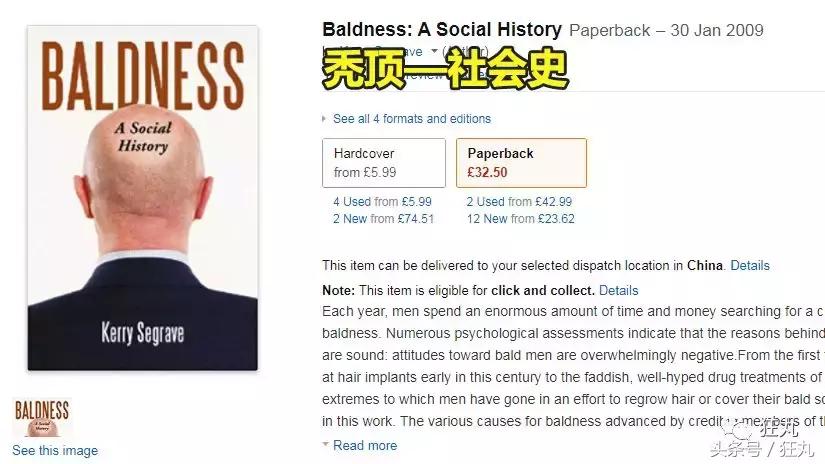 麦当劳薯条治疗脱发,麦当劳薯条掉头发