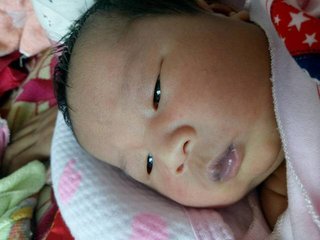 宝宝嘴唇发紫是什么原因引起的,宝宝嘴唇发紫是什么问题呢