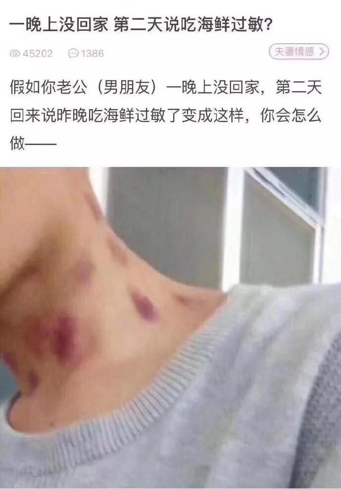 假如你的老公一夜未归,说脖子上的印记是海鲜过敏,你会怎么做?