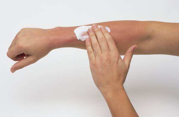 毒木耳的特征和禁忌,鲜木耳有毒的原因