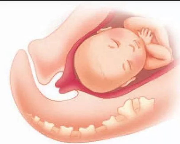 经产妇第一产程时间,准妈妈必知顺产5大良方