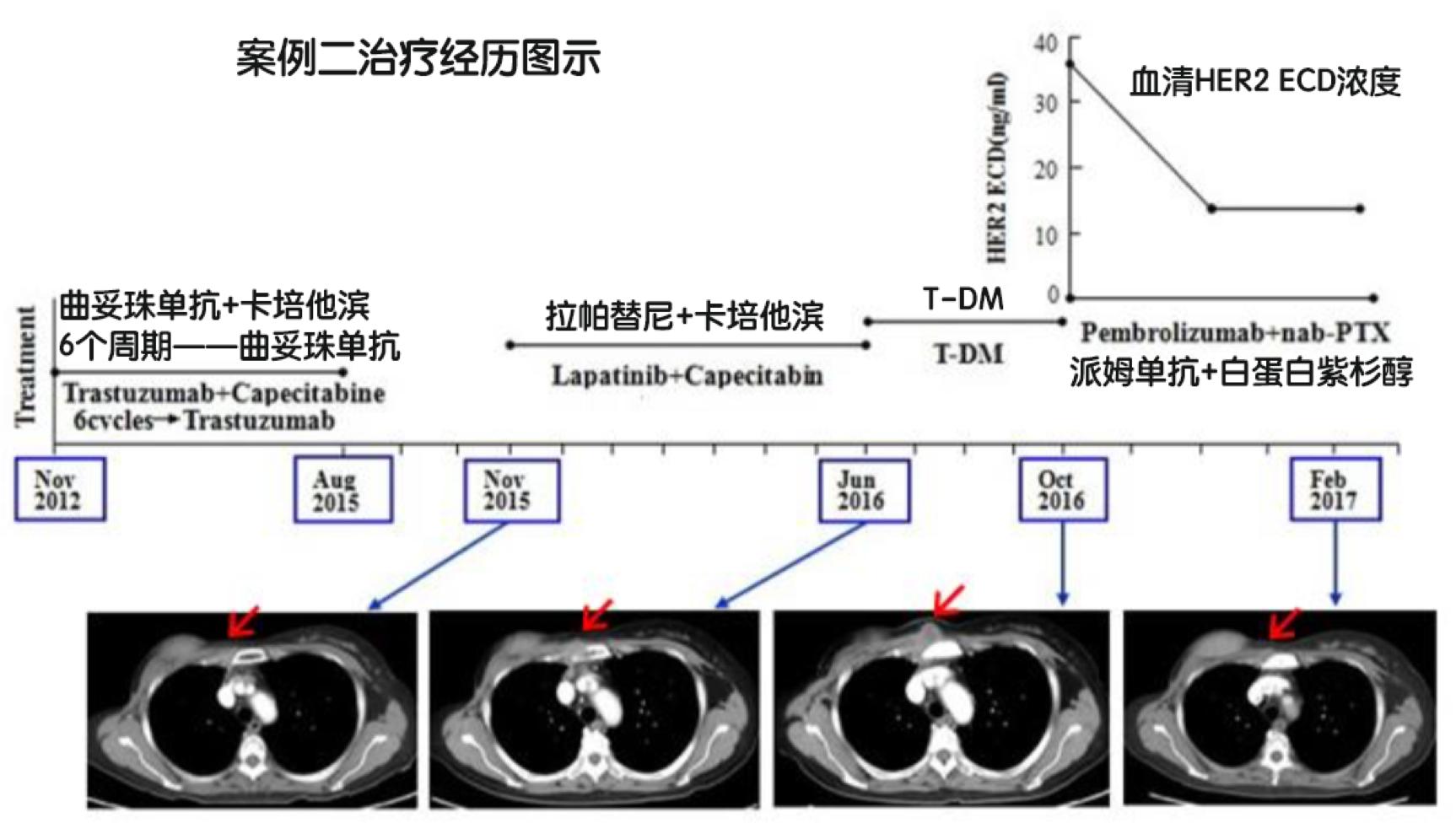 pd1联合紫杉醇卡铂治疗肺癌,pd-1和化疗哪个副作用大