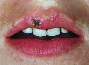 过年大鱼大肉吃什么解腻,过年大鱼大肉少不了多吃这些东西