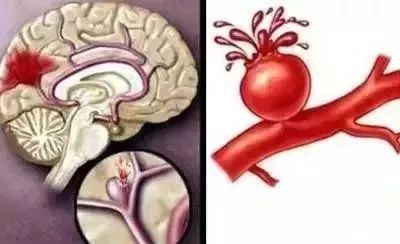 倒春寒哪个部位不能冻,倒春寒注意身体