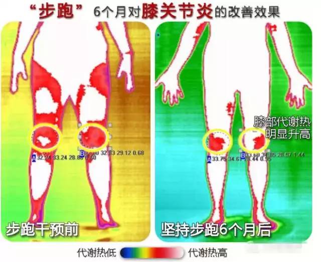 哪些运动可以缓解关节不适,关节不舒服要停止训练吗