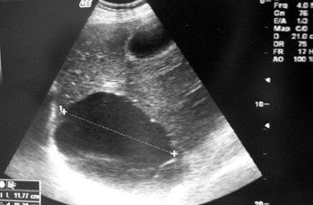 测一测你怀孕是怎么样的,测胎儿男孩女孩方法