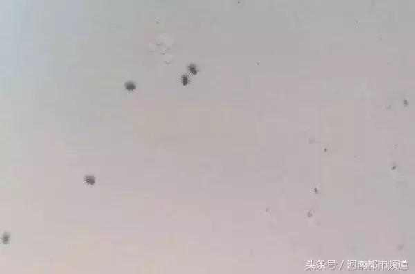 河南什么地方出现大量黑虫,河南村民发现红色线虫