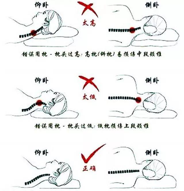 颈椎病引起头疼头晕中成药,颈椎病引起头疼头晕中药方