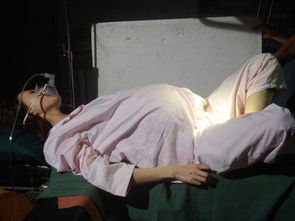 同样是顺产，有的侧切有的为什么不用？