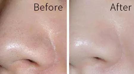 毛孔一擦就变细腻,用了一段时间毛孔收缩了一点