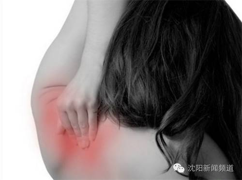 如果你身上有很多包要怎么办,如果你身上有个痣是好事还是坏事