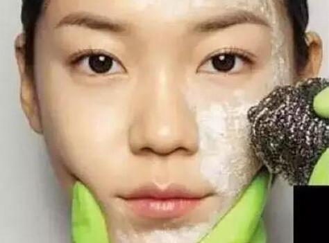 油性皮肤毛孔粗大怎么改善最有效,毛孔出油粗大如何改善小技巧