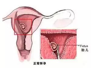输卵管通而不畅可以促排吗,好好的怎么会输卵管破裂