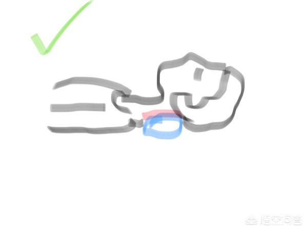 脖子后面富贵鼓包怎么改善,脖子后鼓起来是富贵包吗