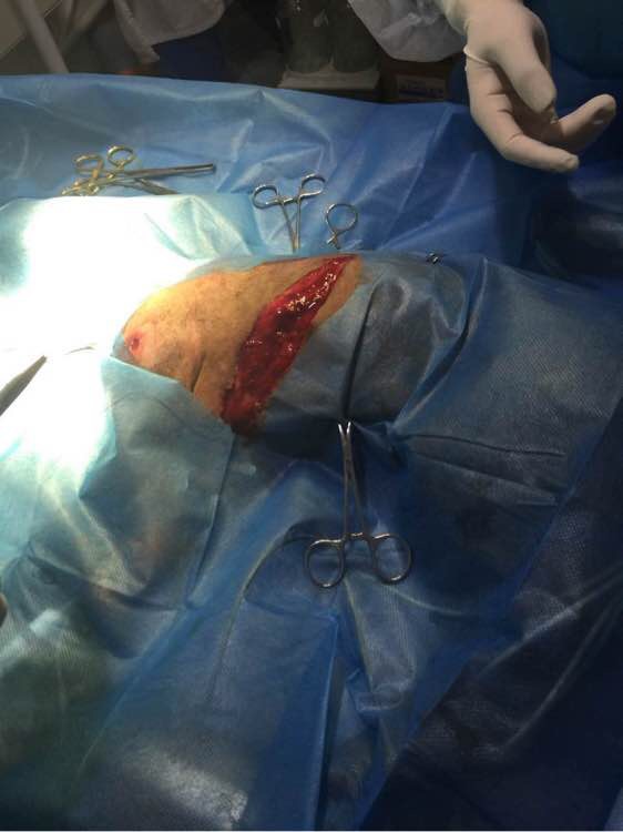 小狗脖子被撕烂险丧命，被缝48针惨不忍睹。