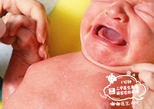 被宝宝压成乳腺炎,新生儿挤乳房得乳腺炎
