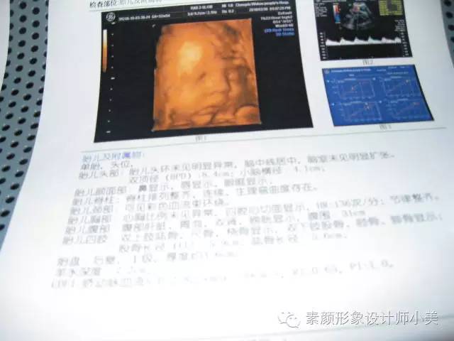 孕育课堂:怀孕三十二周胎儿发育与孕妈变化