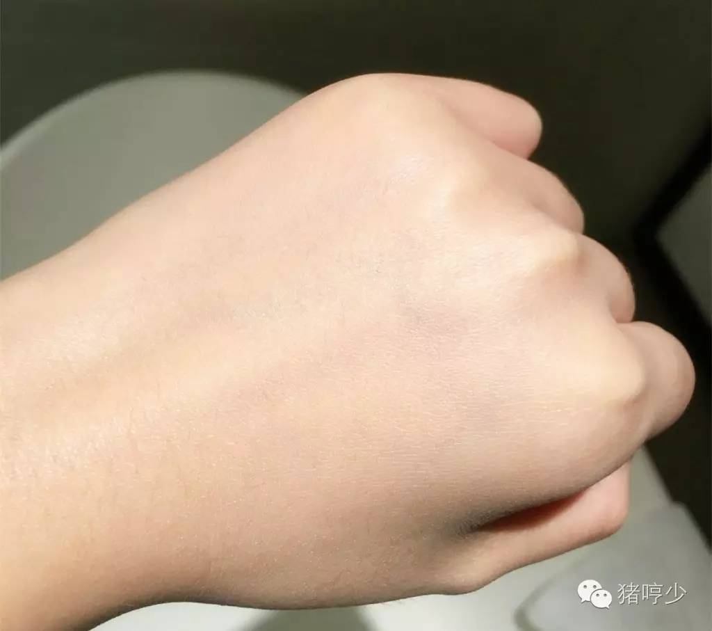 可涂是什么,可涂抹可注入玻尿酸