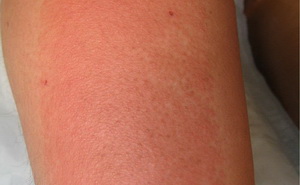 农历五月是毒月,农历五月毒月可信吗