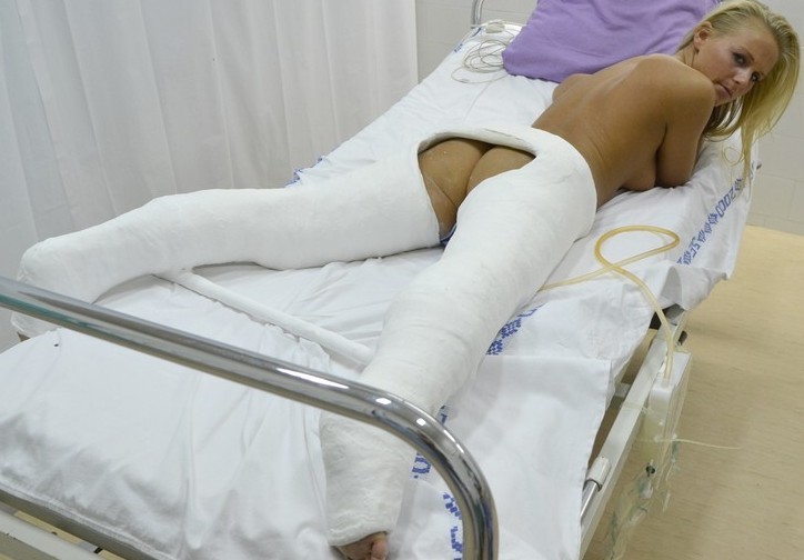 石膏固定的目的及注意事项,石膏固定后注意事项