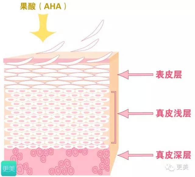 果酸换肤是整容吗,果酸换肤不做后会复发吗