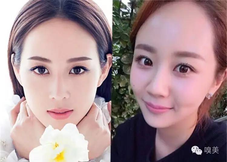 杨紫真的没有整容吗,杨紫脸部最近是不是又整了