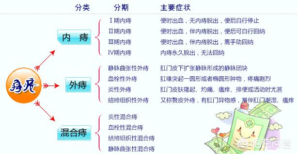 痔疮手术用什么手术方法好,痔疮手术怎么做