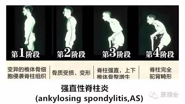 一得这病就是一辈子？！周杰伦张嘉译都中招