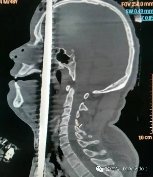 都伤成这样了还奇迹生还!向医生致敬!