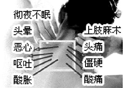 颈椎病、落枕,就找手上这2个穴,3分钟见效