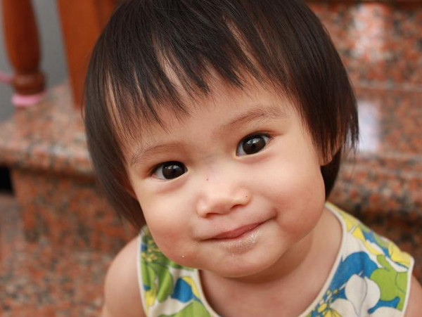 脸上有青筋的小孩面相,宝宝脸上有青筋是怎么回事