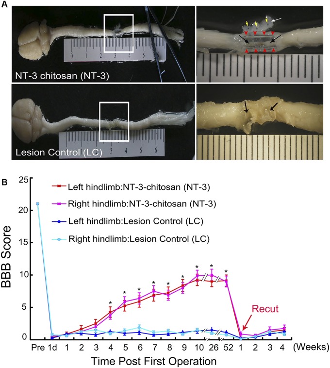 神经再生研究新突破,神经再生研究成果视频