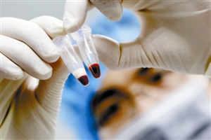 矮小症住院检查需要几天,矮小症做什么检查多少钱