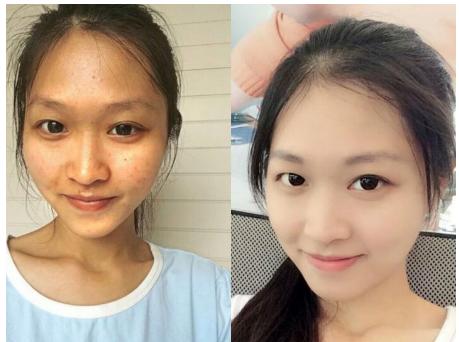 谷胱甘肽全身美白，欧宝妍让您吃出来的瓷肌白