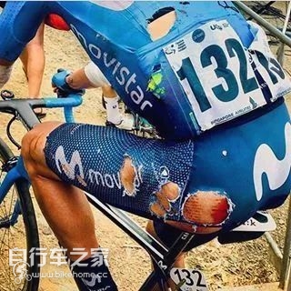 自行车的毛病,自行车的一些大毛病