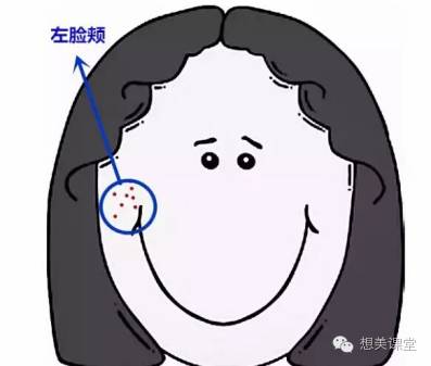 脸再美妆再浓，一颗痘痘毁你容！