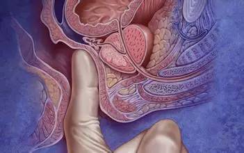 “*菊爆**花”的检查项目尴尬又难受，到底要不要放弃？