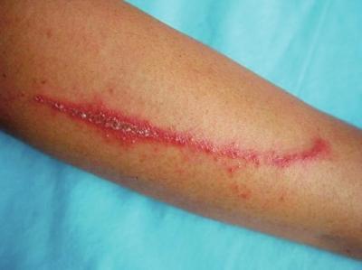 这种小虫子有这么厉害?还能要死人?