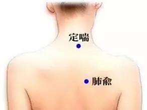 三伏贴可以治愈过敏性鼻炎吗,过敏性鼻炎三伏贴贴什么穴位