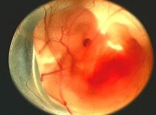 直面那些无法逃避的痛苦,孕期孕妈遇到哪些令人害怕的事