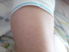 夏季如何防晒保护皮肤,孕妇要怎么护理皮肤