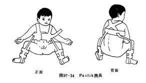 宝宝腿纹不对称但髋关节b超正常,为什么宝宝腿纹不对称髋关节正常