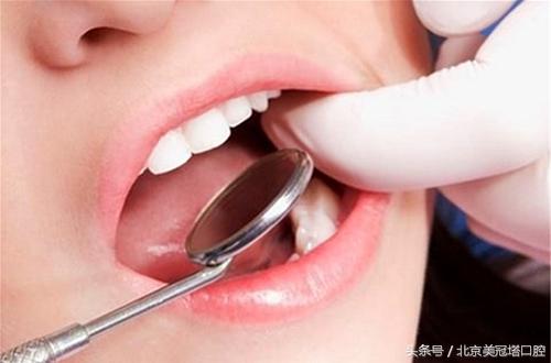 顽固牙菌斑怎么清除,5分钟内消除牙菌斑的6种有效方法