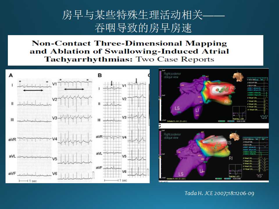 仁济医院射频消融王新华,王新华主要事迹
