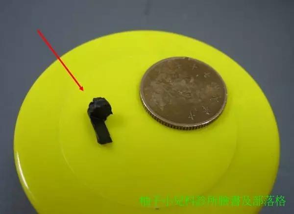 小孩真的什么东西都可以塞进鼻孔?