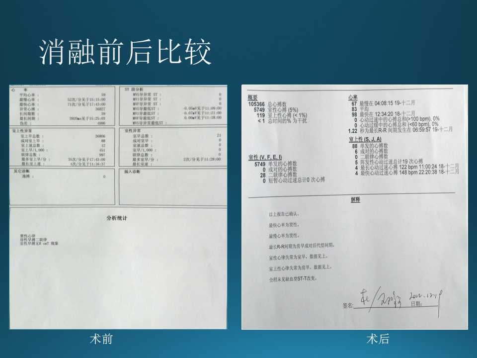 仁济医院射频消融王新华,王新华主要事迹