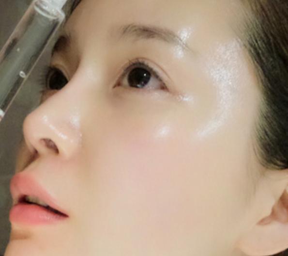 祛痘痘祛痘印推荐学生党11岁,简单又实用的祛痘方法