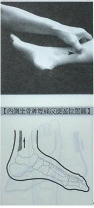 腰椎间盘突出的治疗方法的短视频,腰椎间盘突出的治疗方案有哪些